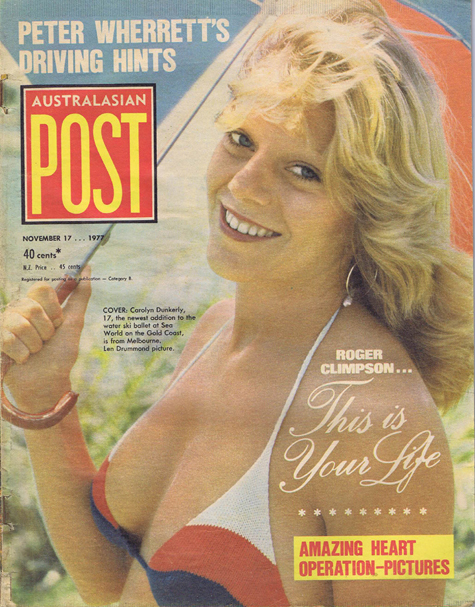 Australasian Post Magazine Nov 17 1977 Amazing Heart operation pictures